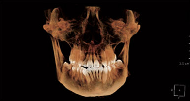 3D Image X-Ray from front FOV